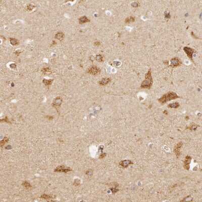 Immunohistochemistry-Paraffin: APP Antibody [NBP1-90246]