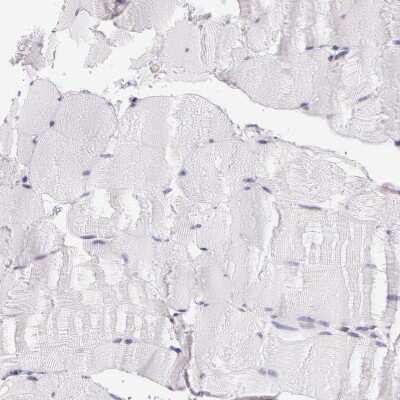 Immunohistochemistry-Paraffin: APP Antibody [NBP1-90246]