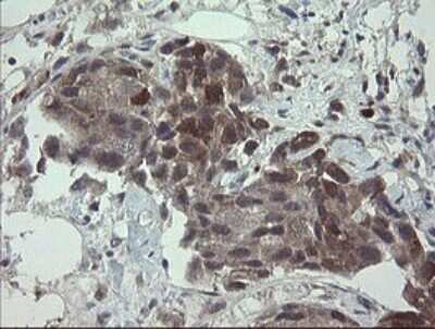 Immunohistochemistry: APP Antibody (OTI4C9) - Azide and BSA Free [NBP2-70197]