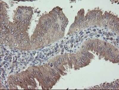 Immunohistochemistry: APP Antibody (OTI4C9) - Azide and BSA Free [NBP2-70197]
