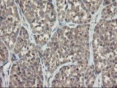 Immunohistochemistry: APP Antibody (OTI4C9) - Azide and BSA Free [NBP2-70197]