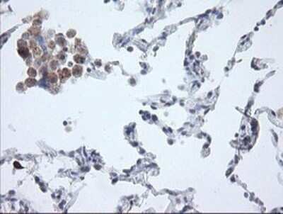 Immunohistochemistry: APP Antibody (OTI4C9) - Azide and BSA Free [NBP2-70197]