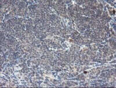 Immunohistochemistry: APP Antibody (OTI4C9) - Azide and BSA Free [NBP2-70197]