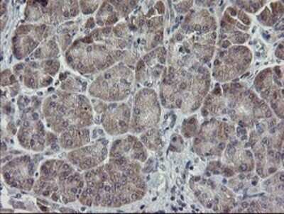 Immunohistochemistry: APP Antibody (OTI4C9) - Azide and BSA Free [NBP2-70197]