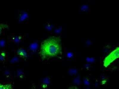 Immunocytochemistry/ Immunofluorescence: APP Antibody (OTI7G9) - Azide and BSA Free [NBP2-70187]