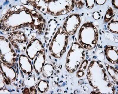 Immunohistochemistry: APP Antibody (OTI7G9) - Azide and BSA Free [NBP2-70187]
