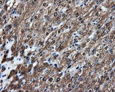 Immunohistochemistry: APP Antibody (OTI7G9) - Azide and BSA Free [NBP2-70187]