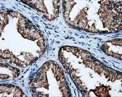 Immunohistochemistry: APP Antibody (OTI7G9) - Azide and BSA Free [NBP2-70187]