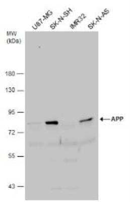 Western Blot: APP Antibody [NBP1-32081]