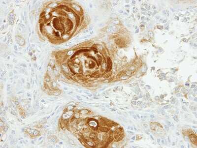 Immunohistochemistry-Paraffin: APPBP2 Antibody [NBP2-15432]