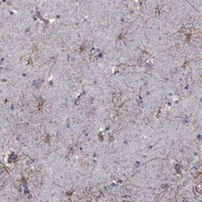 Immunohistochemistry-Paraffin: APPBP2 Antibody [NBP3-17802]