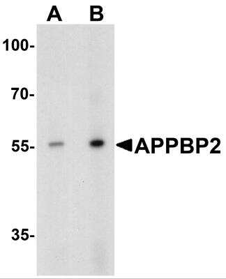 Western Blot: APPBP2 AntibodyBSA Free [NBP2-81781]