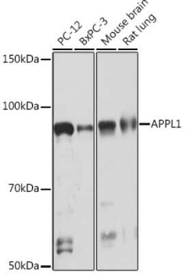 Western Blot: APPL Antibody (4M5X9) [NBP3-16721]