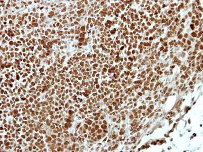 Immunohistochemistry-Paraffin: APPL Antibody [NBP2-15434]