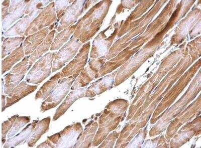 Immunohistochemistry-Paraffin: APPL Antibody [NBP2-15434]