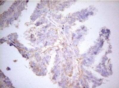 Immunohistochemistry: APPL Antibody (OTI4B11) - Azide and BSA Free [NBP2-71782]