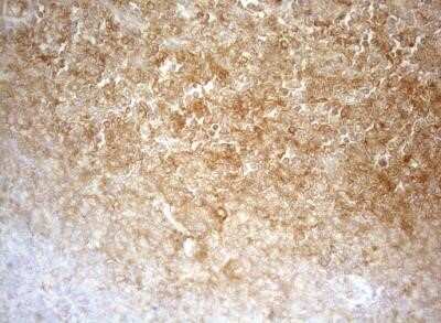 Immunohistochemistry: APPL Antibody (OTI4B11) - Azide and BSA Free [NBP2-71782]