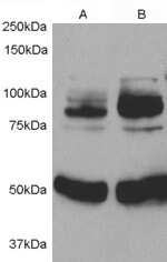 Western Blot: APPL Antibody [NB100-57841]