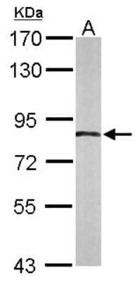 Western Blot: APPL Antibody [NBP2-15433]