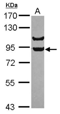 Western Blot: APPL Antibody [NBP2-15433]