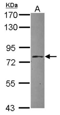 Western Blot: APPL Antibody [NBP2-15434]