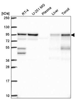 Western Blot: APPL Antibody [NBP2-76565]