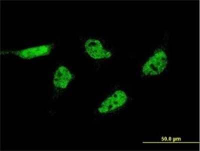 Immunocytochemistry/ Immunofluorescence: APR-2 Antibody (6D11) [H00023591-M01]