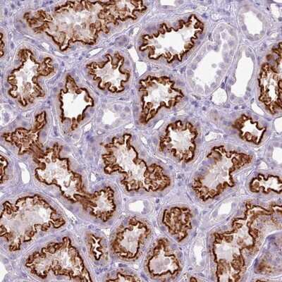 Immunohistochemistry-Paraffin: APR3 Antibody [NBP2-14403]