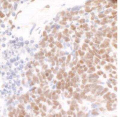 Immunohistochemistry-Paraffin: APRIN Antibody [NB100-755]