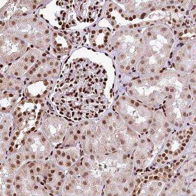 Immunohistochemistry-Paraffin: APRIN Antibody [NBP1-90121]