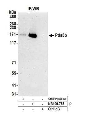Immunoprecipitation: APRIN Antibody [NB100-755]
