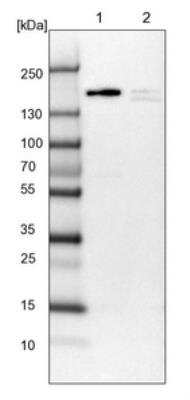 Western Blot: APRIN Antibody [NBP1-90122]