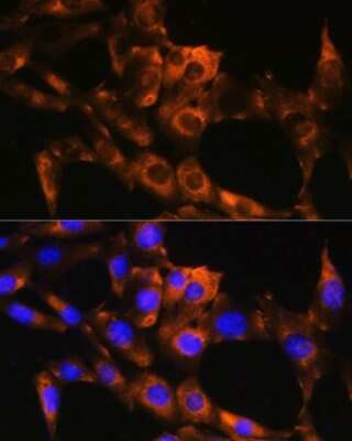 Immunocytochemistry/ Immunofluorescence: APRT Antibody - BSA Free [NBP2-92731]