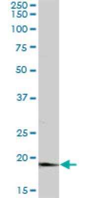 Western Blot: APRT Antibody [H00000353-B01P]