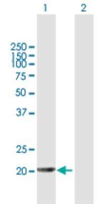 Western Blot: APRT Antibody [H00000353-B01P]