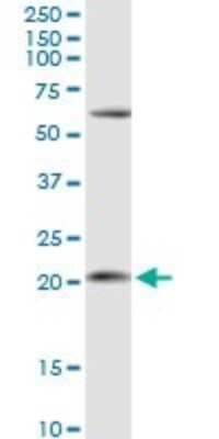 Western Blot: APRT Antibody [H00000353-D01P]