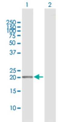 Western Blot: APRT Antibody [H00000353-D01P]