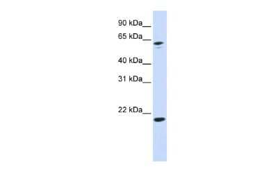 Western Blot: APRT Antibody [NBP1-55300]