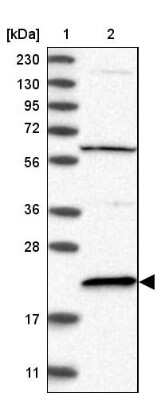 Western Blot: APRT Antibody [NBP1-89519]