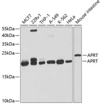 Western Blot: APRT AntibodyBSA Free [NBP2-92654]