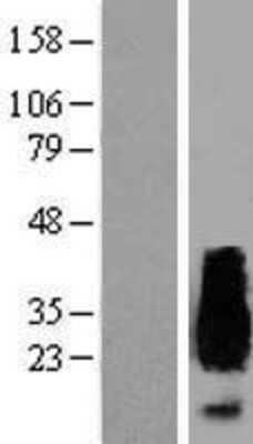 Western Blot: APRT Overexpression Lysate [NBP2-09024]