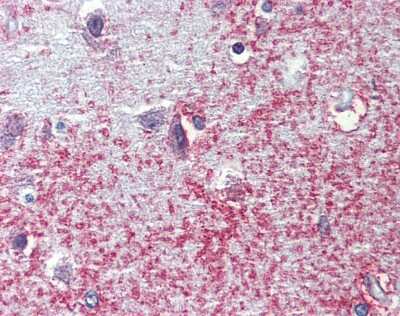 Immunohistochemistry-Paraffin: APXL Antibody [NBP2-15437]