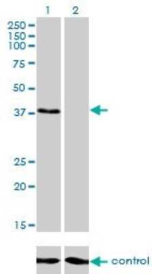 Western Blot: ARA54 Antibody (4G9) [H00009604-M01]