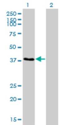 Western Blot: ARA54 Antibody (4G9) [H00009604-M01]