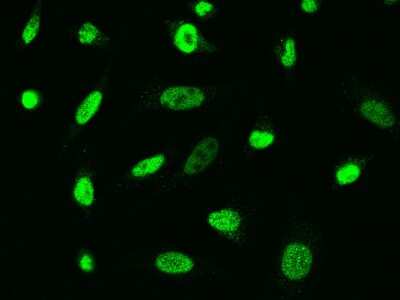 Immunocytochemistry/ Immunofluorescence: ARA54 Antibody [NBP2-99042]