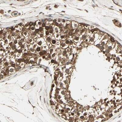 Immunohistochemistry-Paraffin: ARA54 Antibody [NBP1-89021]
