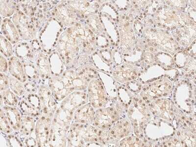 Immunohistochemistry-Paraffin: ARA54 Antibody [NBP2-99042]