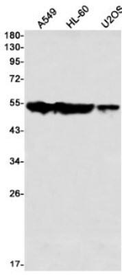 Western Blot: ARA54 Antibody (S01-1H7) [NBP3-20001]