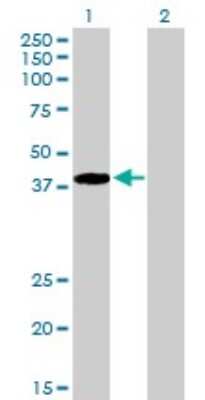 Western Blot: ARA54 Antibody [H00009604-D01P]