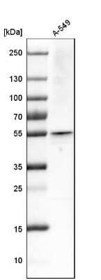 Western Blot: ARA54 Antibody [NBP1-89021]